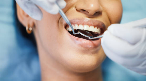 Best Emergency Tooth Extraction in Abbeville, GA